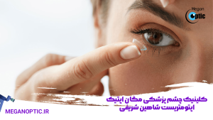 لنزهای تماسی: انواع، مزایا و معایب