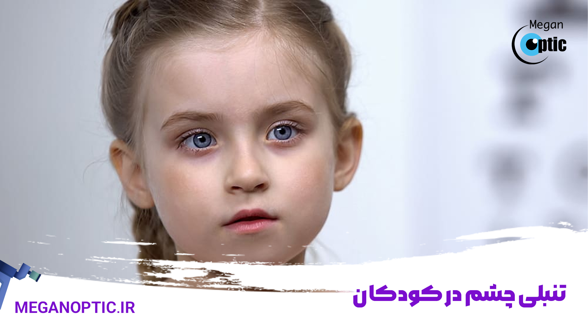 تنبلی چشم در کودکان